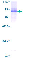 MLLT6 Protein - 12.5% SDS-PAGE of human MLLT6 stained with Coomassie Blue