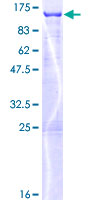 MLPH / Melanophilin Protein - 12.5% SDS-PAGE of human MLPH stained with Coomassie Blue