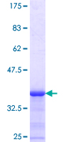 MLR2 / LCOR Protein - 12.5% SDS-PAGE Stained with Coomassie Blue.