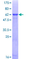 MLST8 / GBL Protein - 12.5% SDS-PAGE of human MLST8 stained with Coomassie Blue