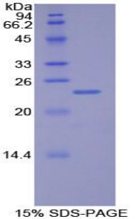 MLST8 / GBL Protein - Recombinant G Protein Beta Subunit Like Protein By SDS-PAGE