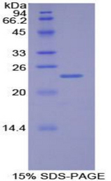 MLST8 / GBL Protein - Recombinant G Protein Beta Subunit Like Protein By SDS-PAGE