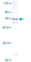 MLX / TCFL4 Protein - 12.5% SDS-PAGE of human MLX stained with Coomassie Blue