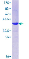 MLXIP / MONDOA Protein - 12.5% SDS-PAGE Stained with Coomassie Blue.