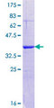 MLXIPL / CHREBP Protein - 12.5% SDS-PAGE Stained with Coomassie Blue.