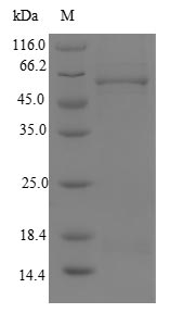 MLYCD / MCD Protein - (Tris-Glycine gel) Discontinuous SDS-PAGE (reduced) with 5% enrichment gel and 15% separation gel.