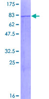 MLYCD / MCD Protein - 12.5% SDS-PAGE of human MLYCD stained with Coomassie Blue