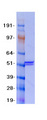 MLYCD / MCD Protein - Purified recombinant protein MLYCD was analyzed by SDS-PAGE gel and Coomassie Blue Staining