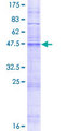MMA / MMD Protein - 12.5% SDS-PAGE of human MMD stained with Coomassie Blue