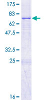 MMAA Protein - 12.5% SDS-PAGE of human MMAA stained with Coomassie Blue