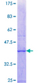 MMAA Protein - 12.5% SDS-PAGE Stained with Coomassie Blue.