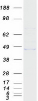 MMAA Protein - Purified recombinant protein MMAA was analyzed by SDS-PAGE gel and Coomassie Blue Staining