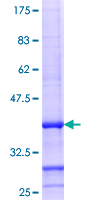 MMAB Protein - 12.5% SDS-PAGE Stained with Coomassie Blue.