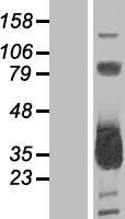 MMACHC Protein - Western validation with an anti-DDK antibody * L: Control HEK293 lysate R: Over-expression lysate
