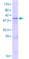 MMACHC Protein - 12.5% SDS-PAGE of human MMACHC stained with Coomassie Blue