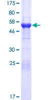 MMADHC / C2orf25 Protein - 12.5% SDS-PAGE of human C2orf25 stained with Coomassie Blue