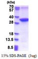 MMADHC / C2orf25 Protein