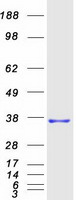 MMADHC / C2orf25 Protein - Purified recombinant protein MMADHC was analyzed by SDS-PAGE gel and Coomassie Blue Staining