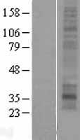 MMD2 Protein - Western validation with an anti-DDK antibody * L: Control HEK293 lysate R: Over-expression lysate
