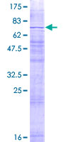 MMD2 Protein - 12.5% SDS-PAGE of human MMD2 stained with Coomassie Blue