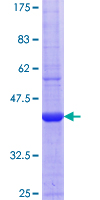MME / CD10 Protein - 12.5% SDS-PAGE Stained with Coomassie Blue.
