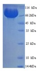 MME / CD10 Protein