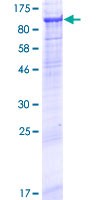 MMEL1 Protein - 12.5% SDS-PAGE of human MMEL1 stained with Coomassie Blue