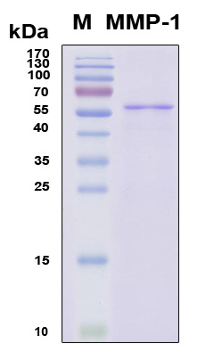 MMP1 Protein - SDS-PAGE under reducing conditions and visualized by Coomassie blue staining