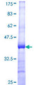 MMP1 Protein - 12.5% SDS-PAGE Stained with Coomassie Blue.