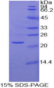 MMP1 Protein - Recombinant Matrix Metalloproteinase 1 By SDS-PAGE