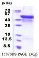 MMP1 Protein