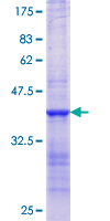 MMP10 Protein - 12.5% SDS-PAGE Stained with Coomassie Blue.
