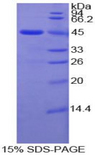 MMP10 Protein - Recombinant Matrix Metalloproteinase 10 By SDS-PAGE