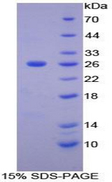 MMP11 Protein - Recombinant Matrix Metalloproteinase 11 By SDS-PAGE
