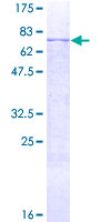 MMP12 Protein - 12.5% SDS-PAGE of human MMP12 stained with Coomassie Blue