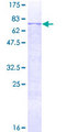 MMP12 Protein - 12.5% SDS-PAGE of human MMP12 stained with Coomassie Blue
