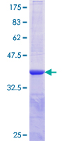 MMP12 Protein - 12.5% SDS-PAGE Stained with Coomassie Blue.