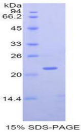 MMP12 Protein - Recombinant Matrix Metalloproteinase 12 By SDS-PAGE