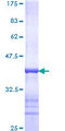 MMP13 Protein - 12.5% SDS-PAGE Stained with Coomassie Blue.