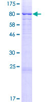 MMP14 Protein - 12.5% SDS-PAGE of human MMP14 stained with Coomassie Blue