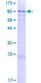 MMP14 Protein - 12.5% SDS-PAGE of human MMP14 stained with Coomassie Blue