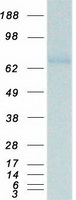 MMP14 Protein - Purified recombinant protein MMP14 was analyzed by SDS-PAGE gel and Coomassie Blue Staining