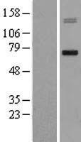 MMP15 Protein - Western validation with an anti-DDK antibody * L: Control HEK293 lysate R: Over-expression lysate
