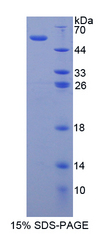 MMP15 Protein - Recombinant  Matrix Metalloproteinase 15 By SDS-PAGE