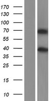 MMP16 Protein - Western validation with an anti-DDK antibody * L: Control HEK293 lysate R: Over-expression lysate