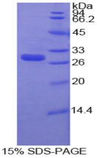 MMP16 Protein - Recombinant Matrix Metalloproteinase 16 By SDS-PAGE