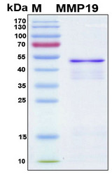 MMP19 Protein - SDS-PAGE under reducing conditions and visualized by Coomassie blue staining