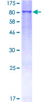 MMP19 Protein - 12.5% SDS-PAGE of human MMP19 stained with Coomassie Blue