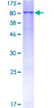 MMP19 Protein - 12.5% SDS-PAGE of human MMP19 stained with Coomassie Blue