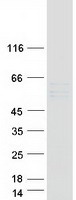 MMP19 Protein - Purified recombinant protein MMP19 was analyzed by SDS-PAGE gel and Coomassie Blue Staining